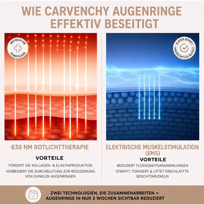 Carvenchy NovaEyes